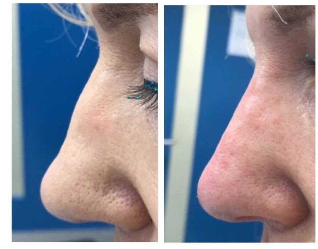 mya cosmetic surgery reviews