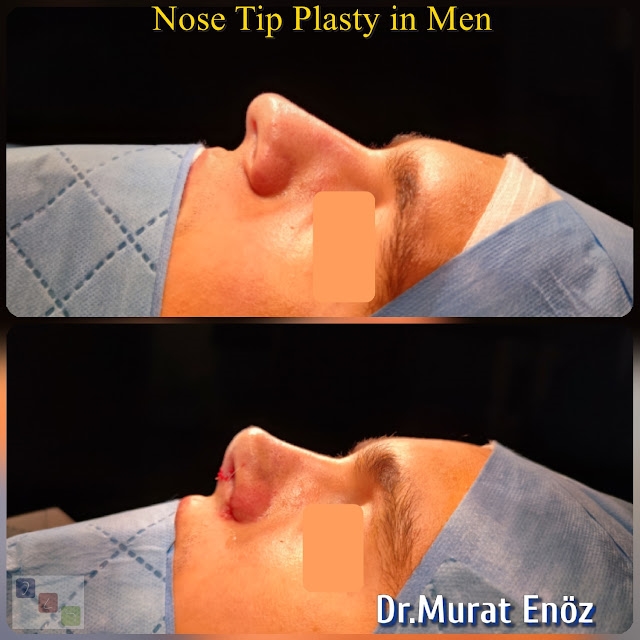 mya cosmetic surgery reviews